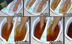 سم زدایی دیجیتالی از کف پا و دفع مواد زیست محیطی از بدن در کلینیک پوست و زیبایی ونک