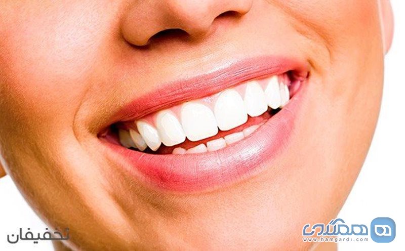66% تخفیف خدمات متنوع زیبایی دندان در دندانپزشکی لبخند سفید