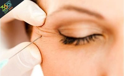 تهران-طراحی-صورت-و-زیبایی-طبیعی-با-تزریق-ژل-در-مطب-دکتر-علیزاده-72734