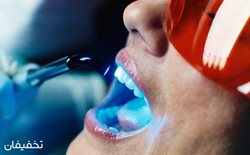87% تخفیف جرمگیری و بروساژ دندان در کلینیک دندانپزشکی دریای نور