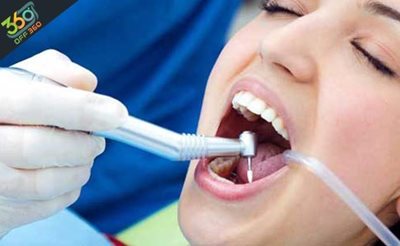 تهران-خدمات-مختلف-دندان-عصب-کشی-پر-کردن-کشیدن-در-کلینیک-دندانپزشکی-لبخند-زیبا-75756