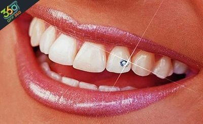 تهران-خدمات-مختلف-دندان-عصب-کشی-پر-کردن-کشیدن-در-کلینیک-دندانپزشکی-لبخند-زیبا-75754