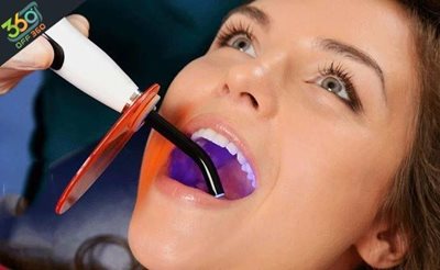تهران-خدمات-مختلف-دندان-عصب-کشی-پر-کردن-کشیدن-در-کلینیک-دندانپزشکی-لبخند-زیبا-75753