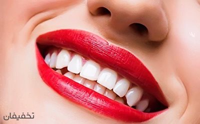 تهران-40-تخفیف-بن-استفاده-از-خدمات-مرکزتخصصی-دندانپزشکی-سینا-81868