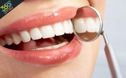 دندان هایی سفید و زیبا با جرم گیری و بروساژ در کلینیک دندانپزشکی لبخند زیبا