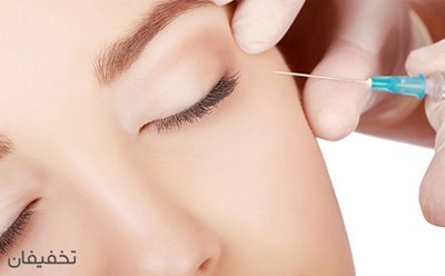 91% تخفیف بوتاکس یا تزریق ژل در مطب دکتر خزعلی