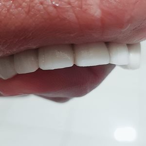 مرودشت-دندانسازی-شهریاری-394768