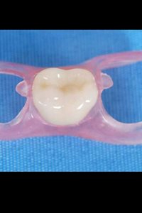 قم-مطب-دندانسازی-مقدم-438716