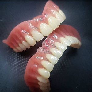 قم-مطب-دندانسازی-مقدم-438715