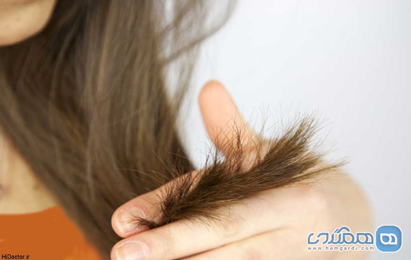 راه هایی برای جلوگیری از ریزش مو