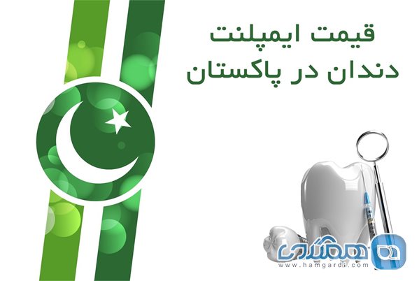 قیمت ایمپلنت دندان در پاکستان