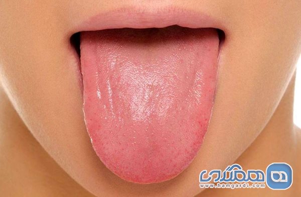 چرا با افزایش سن قدرت چشایی انسان کاهش می یابد؟