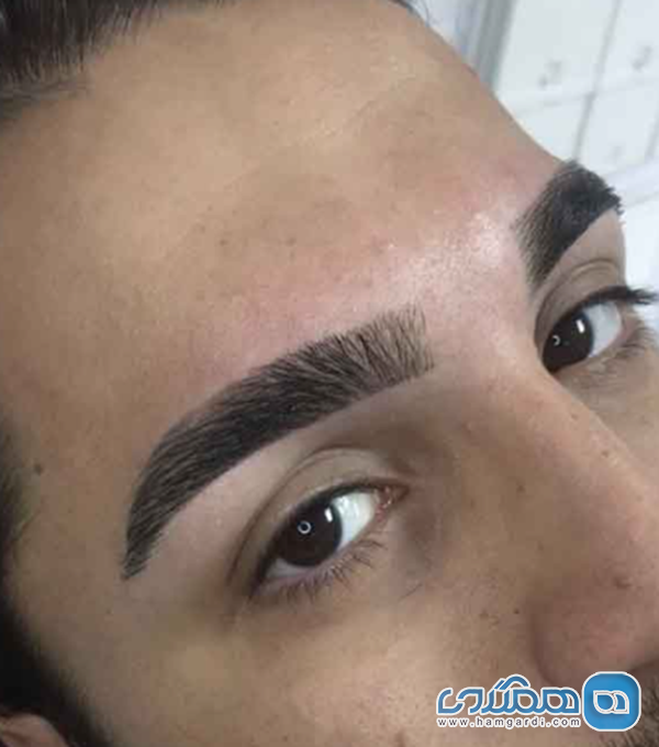 متعادل سازی ابرو: راه حل تخصصی برای چهره های اخمو و خسته